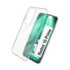 Redmi 10 prime Transparent Back Cover.. Redmi 10 Prime Transparent Back Cover